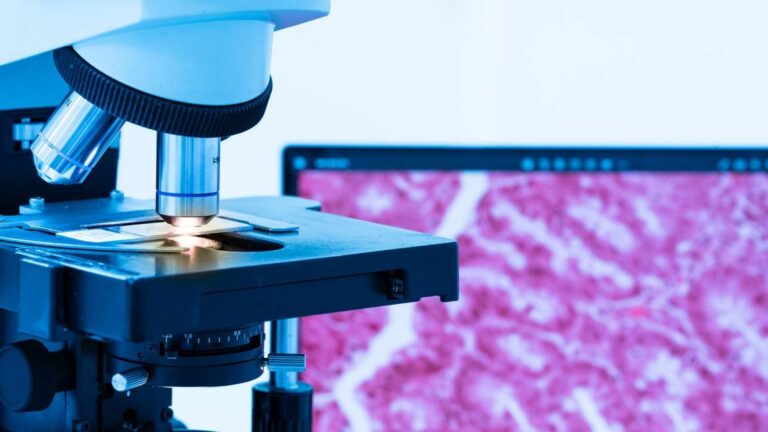 Microscopia vaginal: o exame que identifica a causa do corrimento vaginal